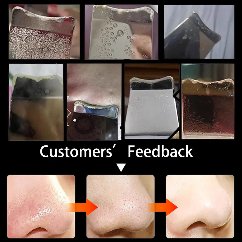 Electric Skin Scrubber for Deep Cleansing and Blackhead Removal with Lifting Ion Technology