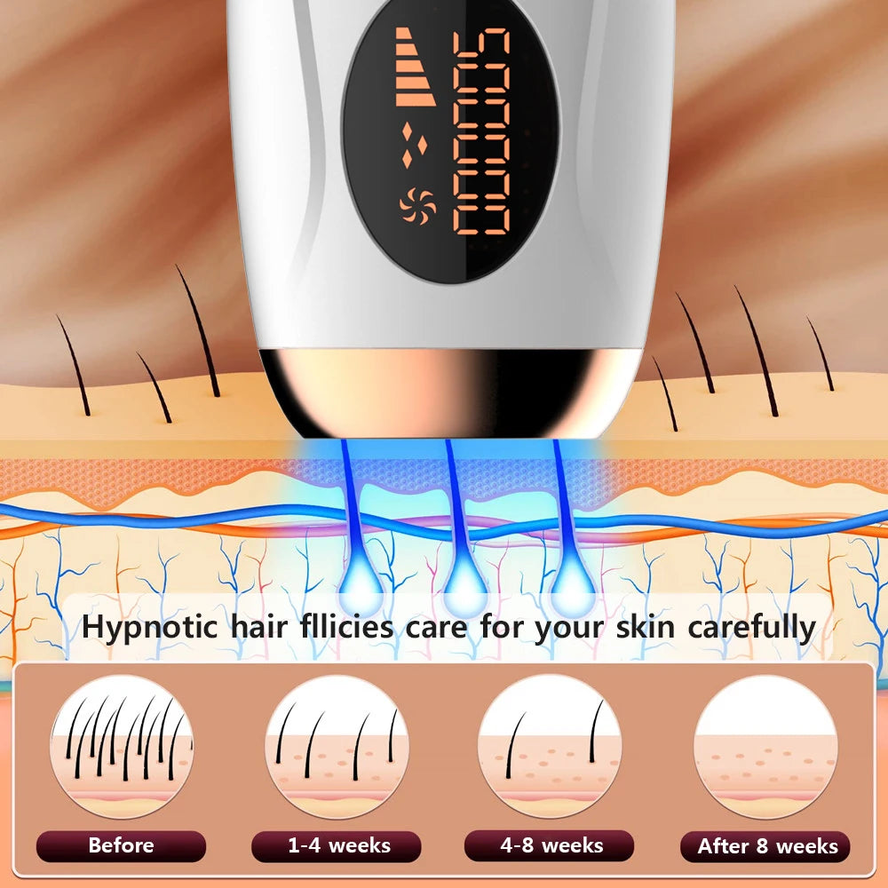 Professional Permanent Laser Hair Removal Device with 999,999 Flashes - Painless Epilator for Women's Body, Facial, Legs, and Bikini Line