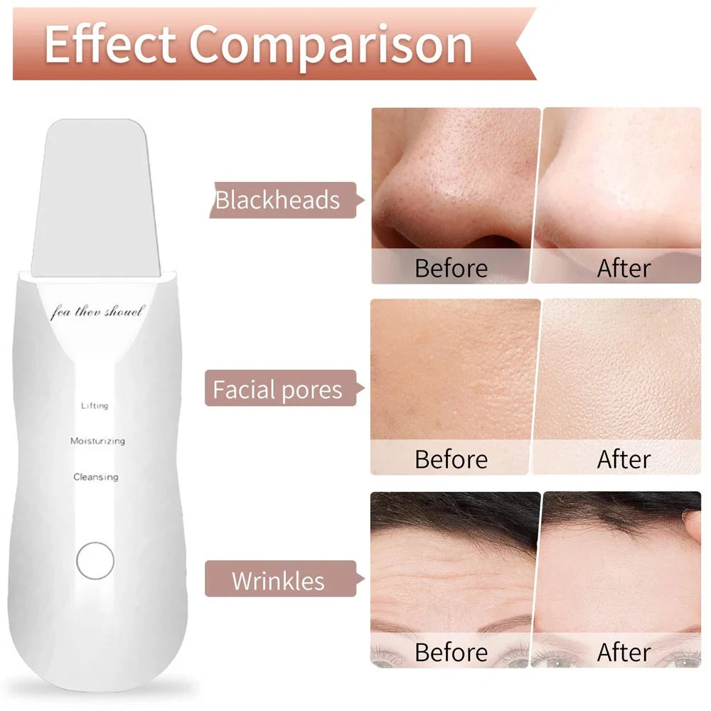 Electric Skin Scrubber for Deep Cleansing and Blackhead Removal with Lifting Ion Technology
