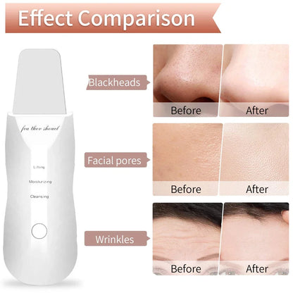 Electric Skin Scrubber for Deep Cleansing and Blackhead Removal with Lifting Ion Technology