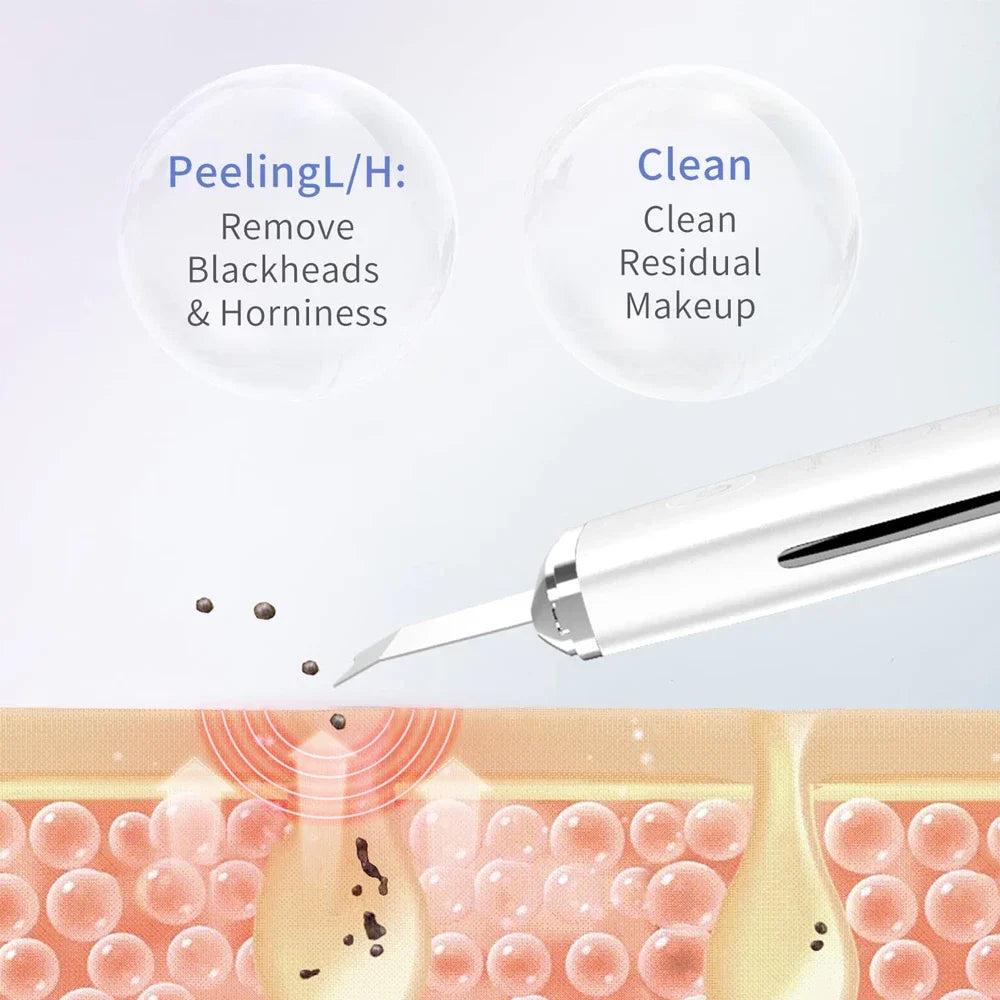 Electric Skin Scrubber for Deep Cleansing and Blackhead Removal with Lifting Ion Technology
