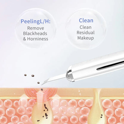 Electric Skin Scrubber for Deep Cleansing and Blackhead Removal with Lifting Ion Technology